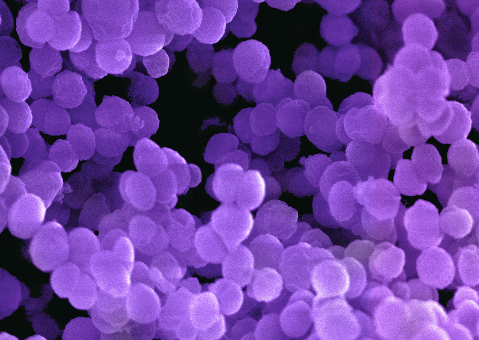 A microscopic view of Neisseria gonorrhoeeae. In this image they look like small purple balls stuck together.