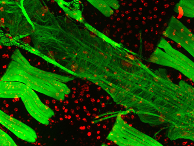 Cardiac muscle fibers of a fruit fly, under a microscope - resembles thick and thin ribbons.